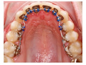 311815--ortodoncia-oi2-1.w1024