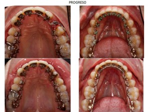 311809--ortodoncia-oi1-2.w1024